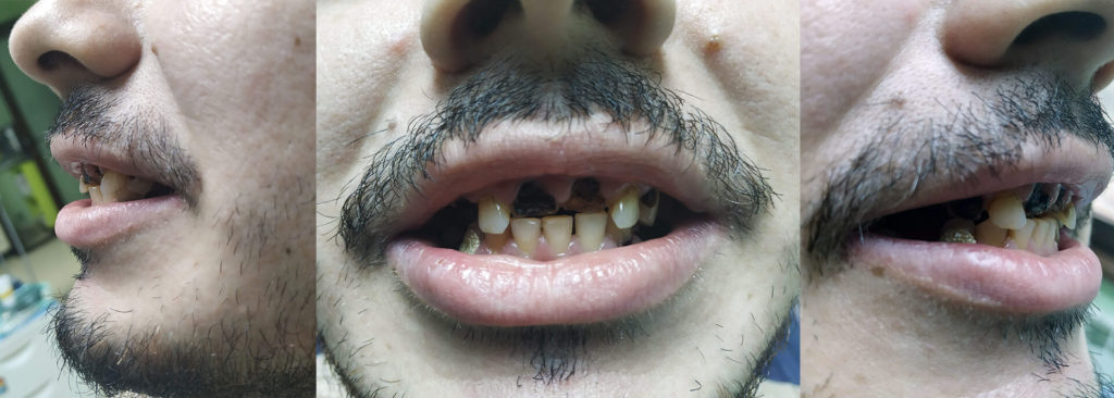 Fotografii realizate înainte de începerea tratamentul dentar